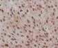 Anti-Phospho-Smad2 (S255) Rabbit Monoclonal Antibody